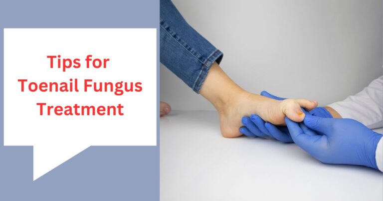 Toenail Fungus Treatment: Top Tips To Remove Toenail Fungus