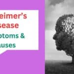 Alzheimers Disease causes and symptoms.