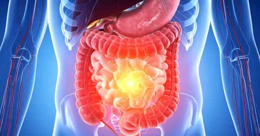 Stress and gut health content.